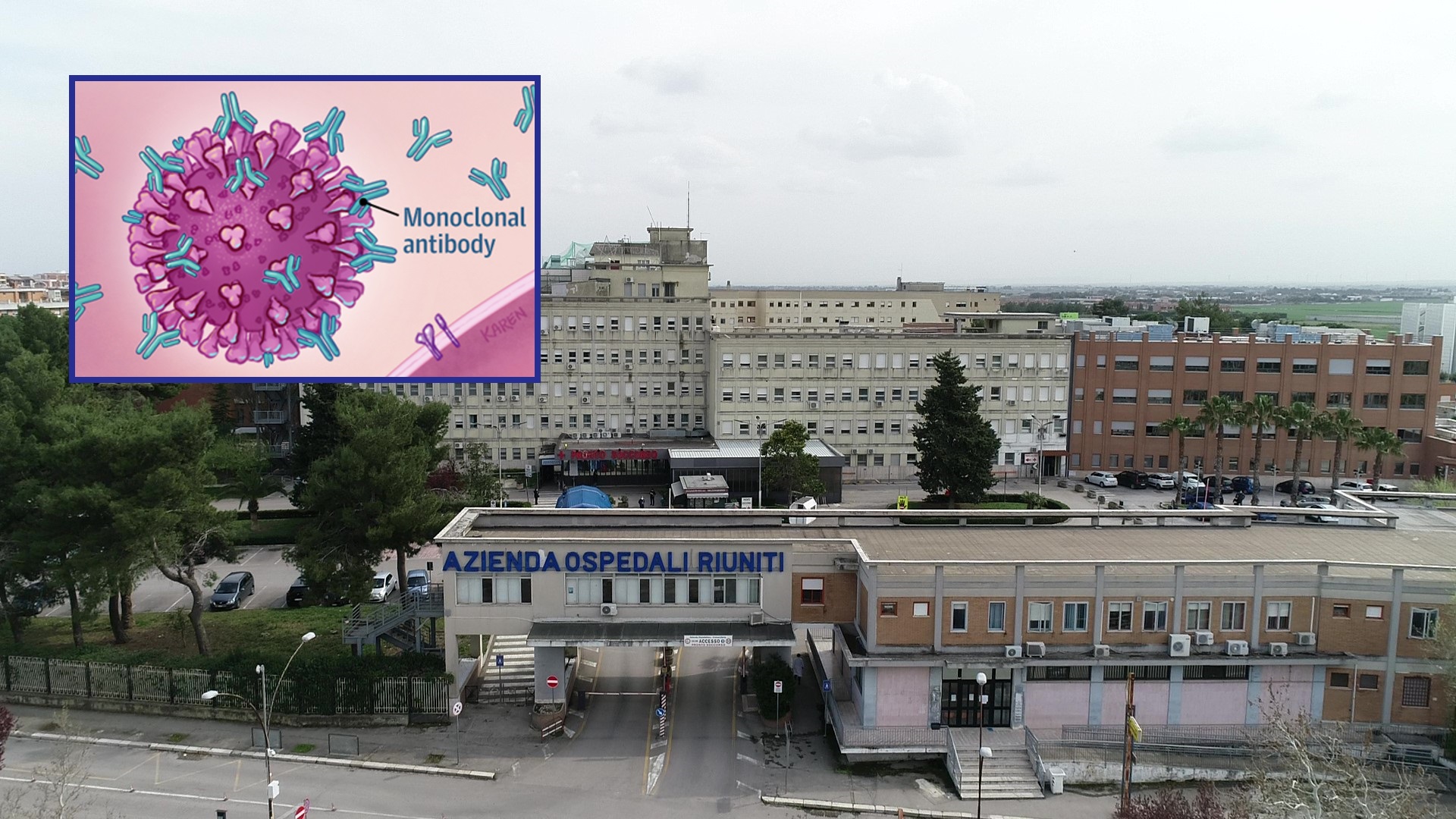 Dal 12 aprile 2021 al via la somministrazione degli anticorpi monoclonali al Policlinico Riuniti di Foggia