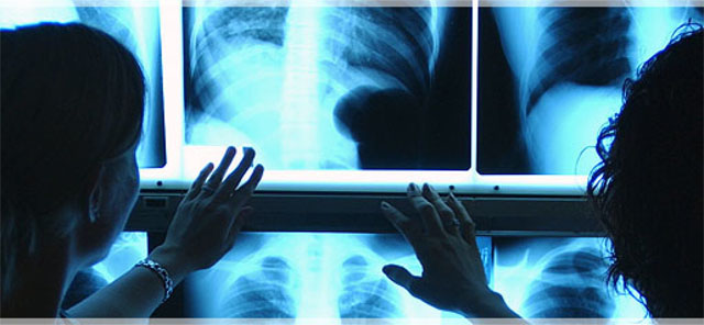 Approvato l’emendamento Tutolo sulla ripartizione equa del fondo regionale per la radiodiagnostica: risultato storico per la Capitanata