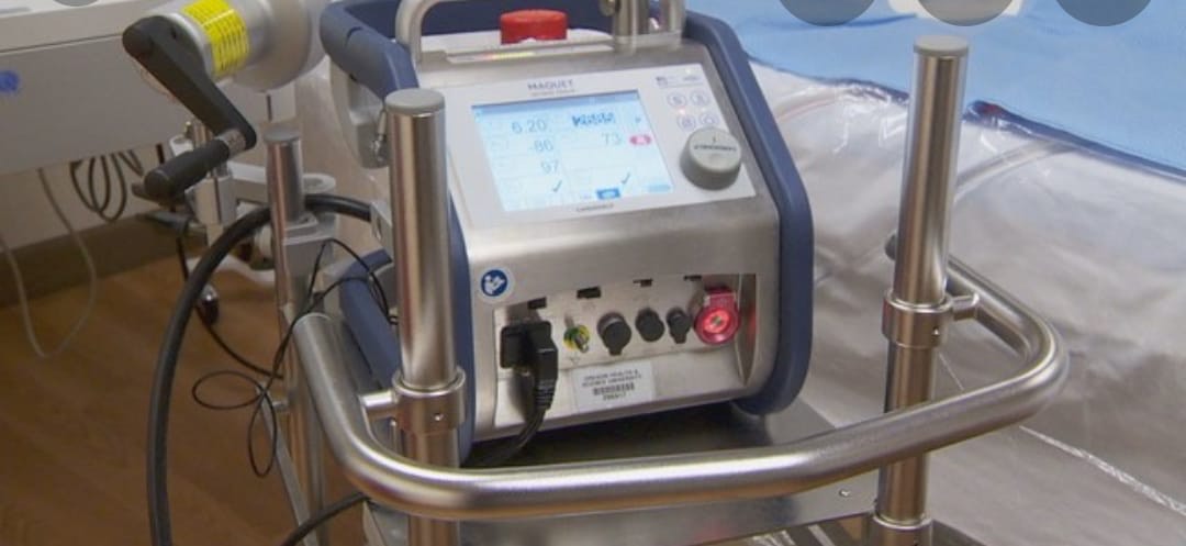 L’AMBIZIOSO PROGETTO DEL POLICLINICO RIUNITI DI FOGGIA: ANCHE QUI LA MACCHINA ECMO PER PAZIENTI CRITICI AFFETTI DA SARS COV-2